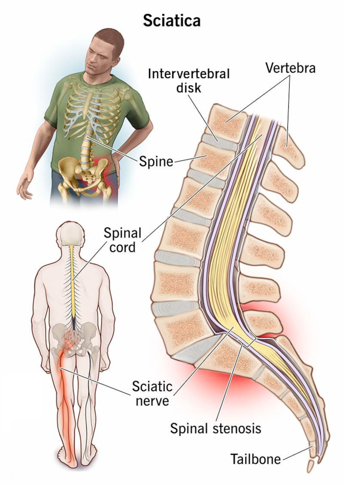Sciatic Stretch